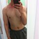 limitz473ACC69